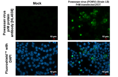 Anti-Powassan virus prM protein antibody [HL4038] used in Immunocytochemistry/ Immunofluorescence (ICC/IF). GTX642369